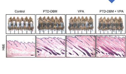 Valproic Acid (VPA) for Hair Restoration - HealthBrew Clinic